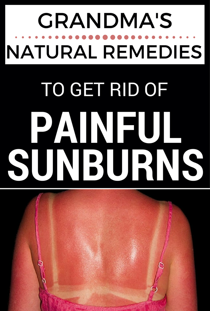 How to quickly get rid of the effects of burns How to quickly get rid of the effects of burns