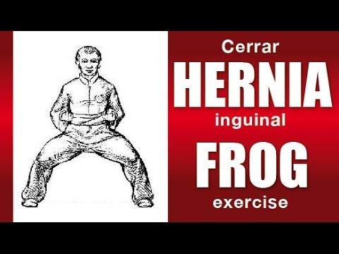 Ejercicios Para Cerrar Una Hernia Inguinal Escrotal Youtube