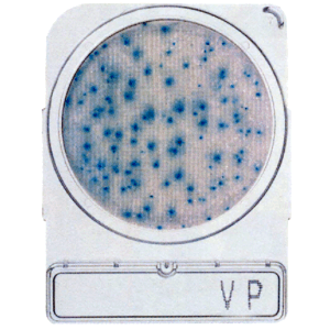 Pin by Termometer Svenska on Odlings Tryckplattor | Compact Pin by Termometer Svenska on Odlings Tryckplattor | Compact