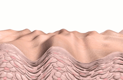 5 in 1 LED Skin Tightening | Skin care devices, Skin tightening, Loose skin