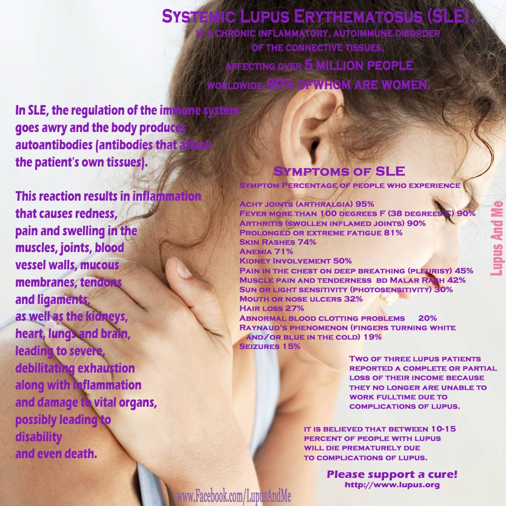 Lupus I Was Diagnosed In June 2012 After A Flare Up That Landed Me In Lupus I Was Diagnosed In June 2012 After A Flare Up That Landed Me In