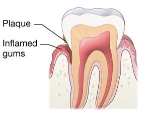 Teeth Gums Diagram Data Wiring Diagram Blog