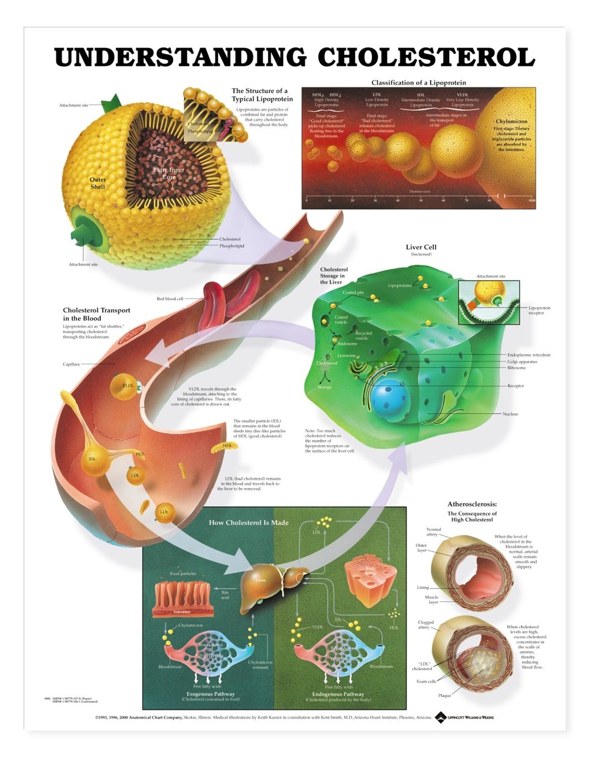 Understanding Cholesterol Poster | Cholesterol Anatomical Chart Company