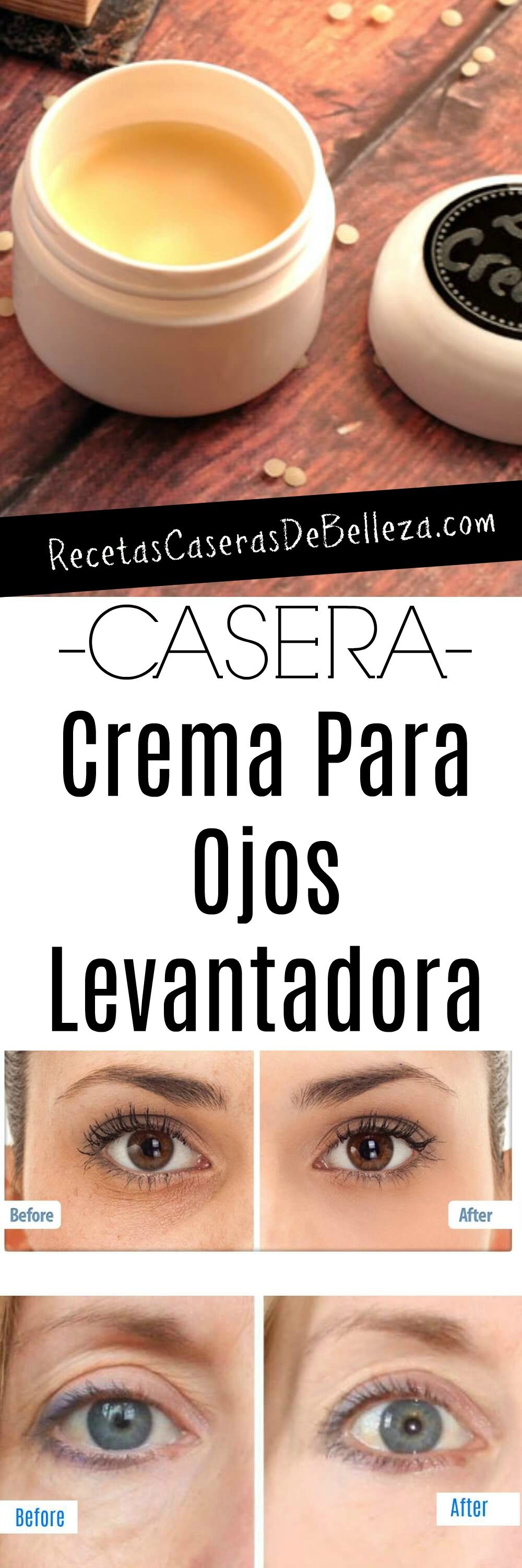 25 Ideas De Bolsas En Los Ojos Tratamientos De Belleza Recetas De Belleza Tips Belleza