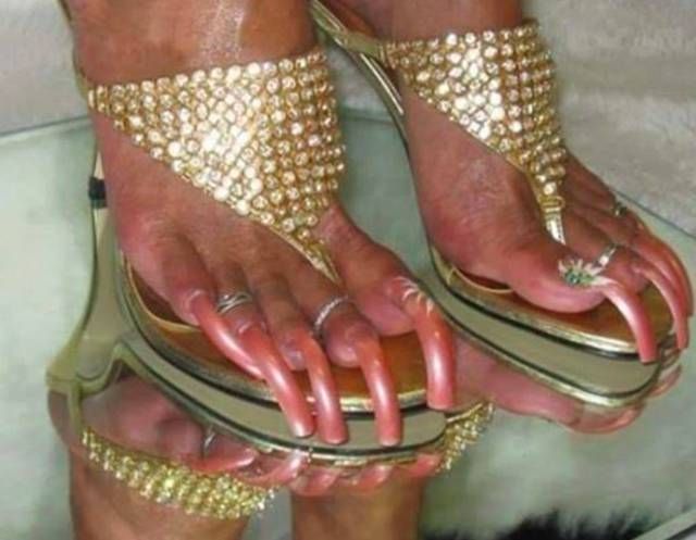 Strange Toe Nails Long And Curly Wow Stuff Strange Toe Nails Long And Curly Wow