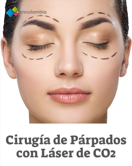 Blefaroplastia láser: rápida, sin morados y sin cicatrices. Cirugía de Párpados con Láser. La tecnología láser ha traído consigo avances en la medicina, reduciendo tiempos de cirugía y ofreciendo múltiples ventajas sobre los procedimientos convencionales. El láser de Co2 es conocido en el mundo de la cirugía plástica y dermocosmética por sus excelentes resultados. Movie Posters, Medicine, World, Beauty Tips, Skin Care, Film Poster, Billboard, Film Posters