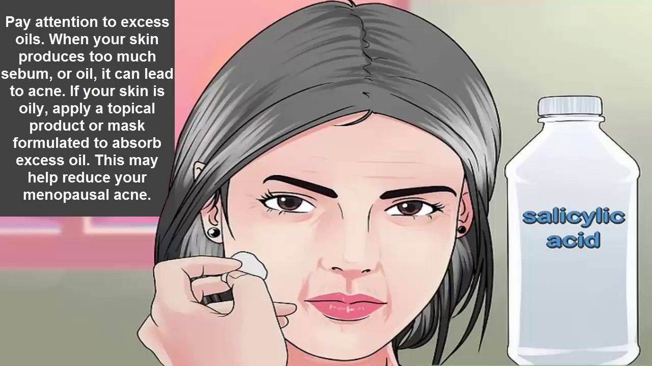 How to Reduce Menopausal Acne advise How to Reduce Menopausal Acne forecast