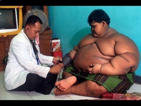 obesidad morbida