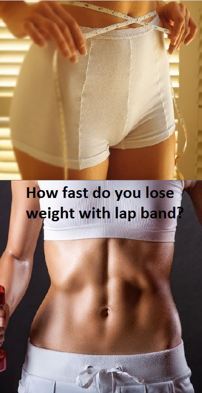 Extreme weight loss makeover before and after image 2