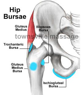 bursitis iliopsoas behandlung)