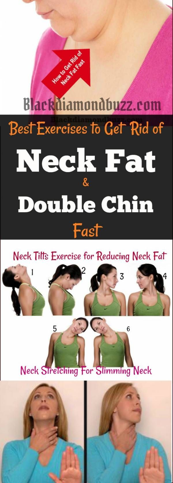 How To Get Rid Of A Crick In Your Neck Overnight
