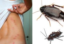 14 Solutions How To Get Rid Of Water Bugs Naturally Fast Get Rid Of Waterbugs How To Get Rid Rid