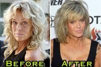 Cum loving twins Facial farrah fawcett picture plastic surgery
