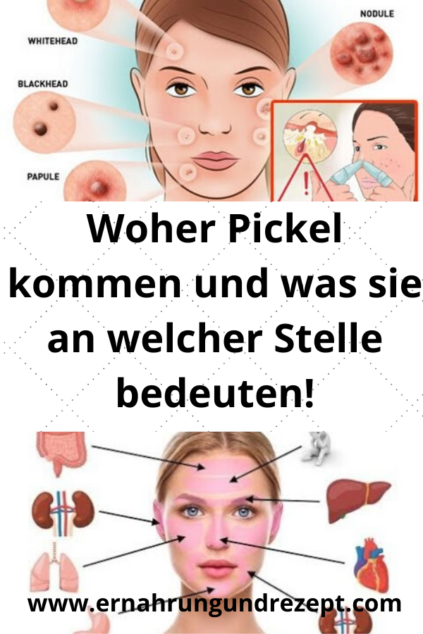 Diät, um Gewicht zu verlieren geschwollene Wangen