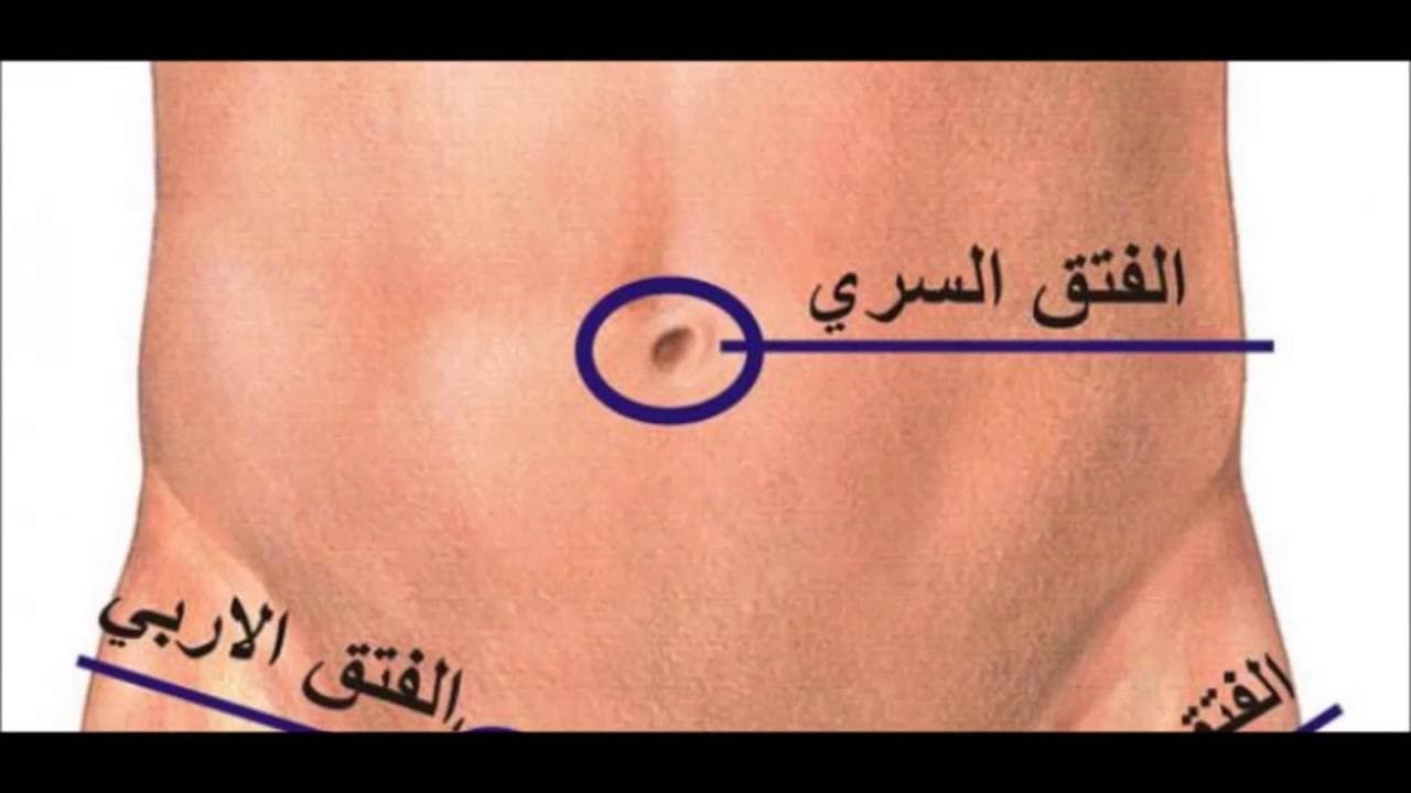 Hernia الفتق