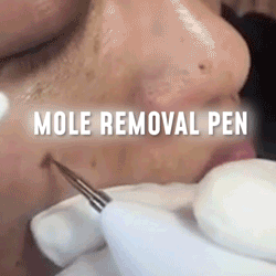 Pin on Skin spot remover