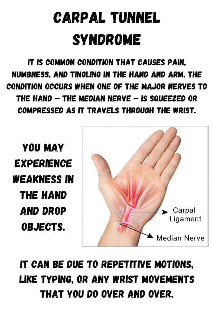 ▶️Home remedies for carpal tunnel relief.. 1️⃣ Ice your wrist or soak it in an ice bath for 10-15 minutes once or twice an hour. 2️⃣ Buy a wrist splint to keep your hand properly aligned. 3️⃣ Take Pain relievers. Carpal Tunnel Remedies, Carpal Tunnel Relief, Carpal Tunnel Syndrome, Median Nerve, Physical Therapy, Arthritis, Home Remedies, Okay Gesture, Movement