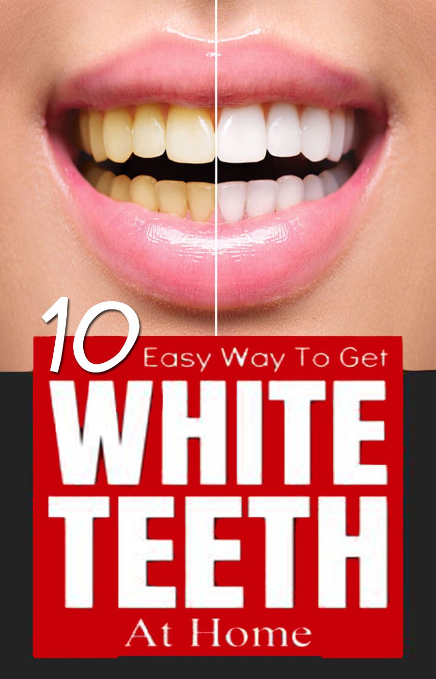 How long will it take to whiten my teeth
