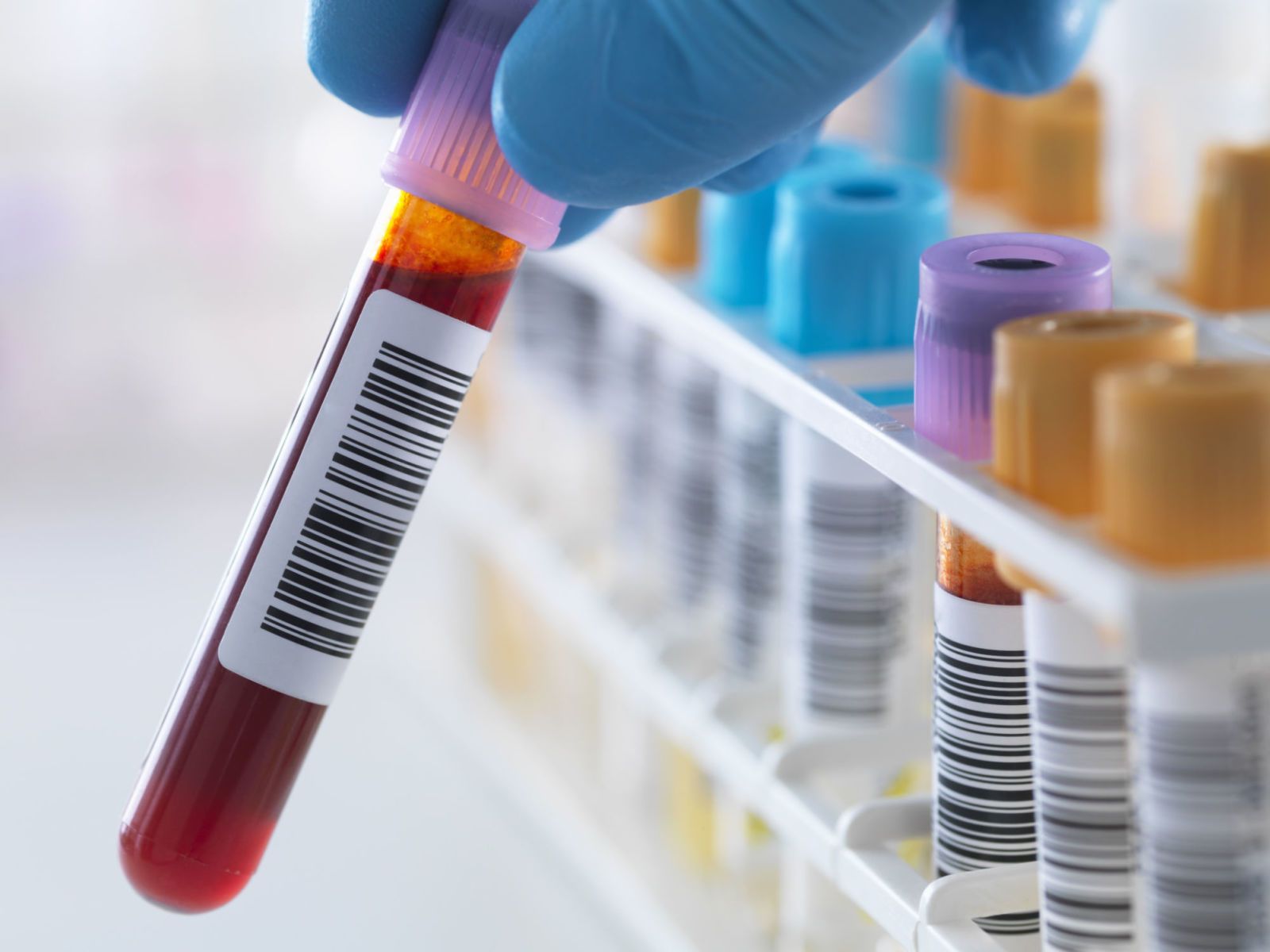 Blood Test Could Predict Breast Cancer Years Earlier advise Blood Test Could Predict Breast Cancer Years Earlier forecasting