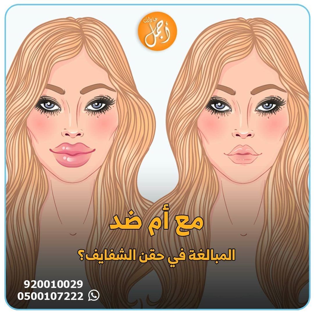 Lip Injection حقن الشفايف Movie Posters Botox Poster