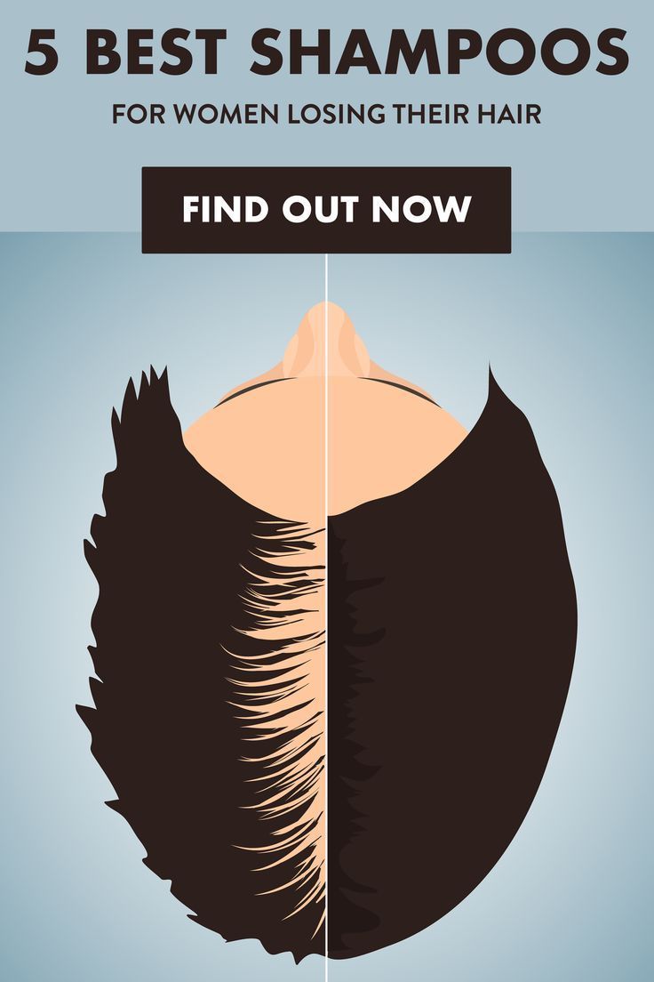 5 Best Shampoos For Women Losing Their Hair 📌 Please Re-Pin for later 😍💞 homework help websites for college students, essay writing linking words, writing an introduction to a thesis, term paper research, find the thesis statement Shampoo For Thinning Hair, Hair Loss Shampoo, Best Shampoo For Women, Curly Hair Styles, Natural Hair Styles, Hair Remedies, Natural Remedies, Herbal Remedies, Best Shampoos