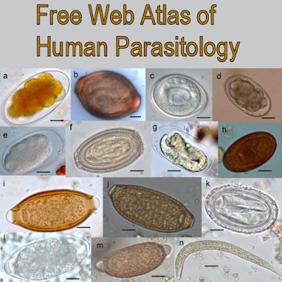 atlas of human parasitology