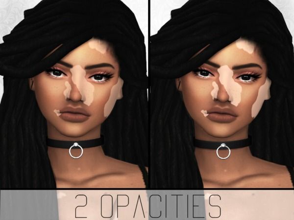 sims 4 vitilgo skin mod sims 4 vitilgo skin mod