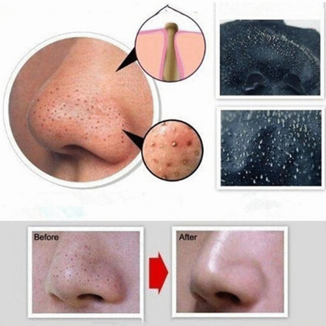 black mud deep cleansing