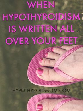10 signs your feet are warning you about a thyroid 10 signs your feet are warning you about a thyroid