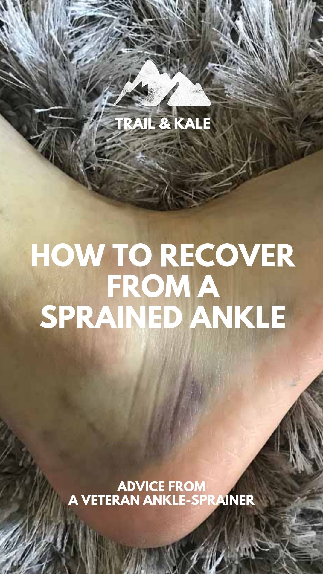 Can You Run On A Sprained Ankle What Do I Do To Treat A Sprained Ankle Treating A Sprained Ankle Sprained Ankle Sprain
