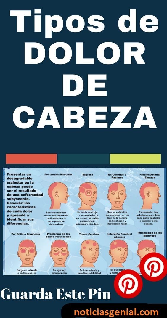 Qué tipo de dolor de cabeza está encima de la cabeza