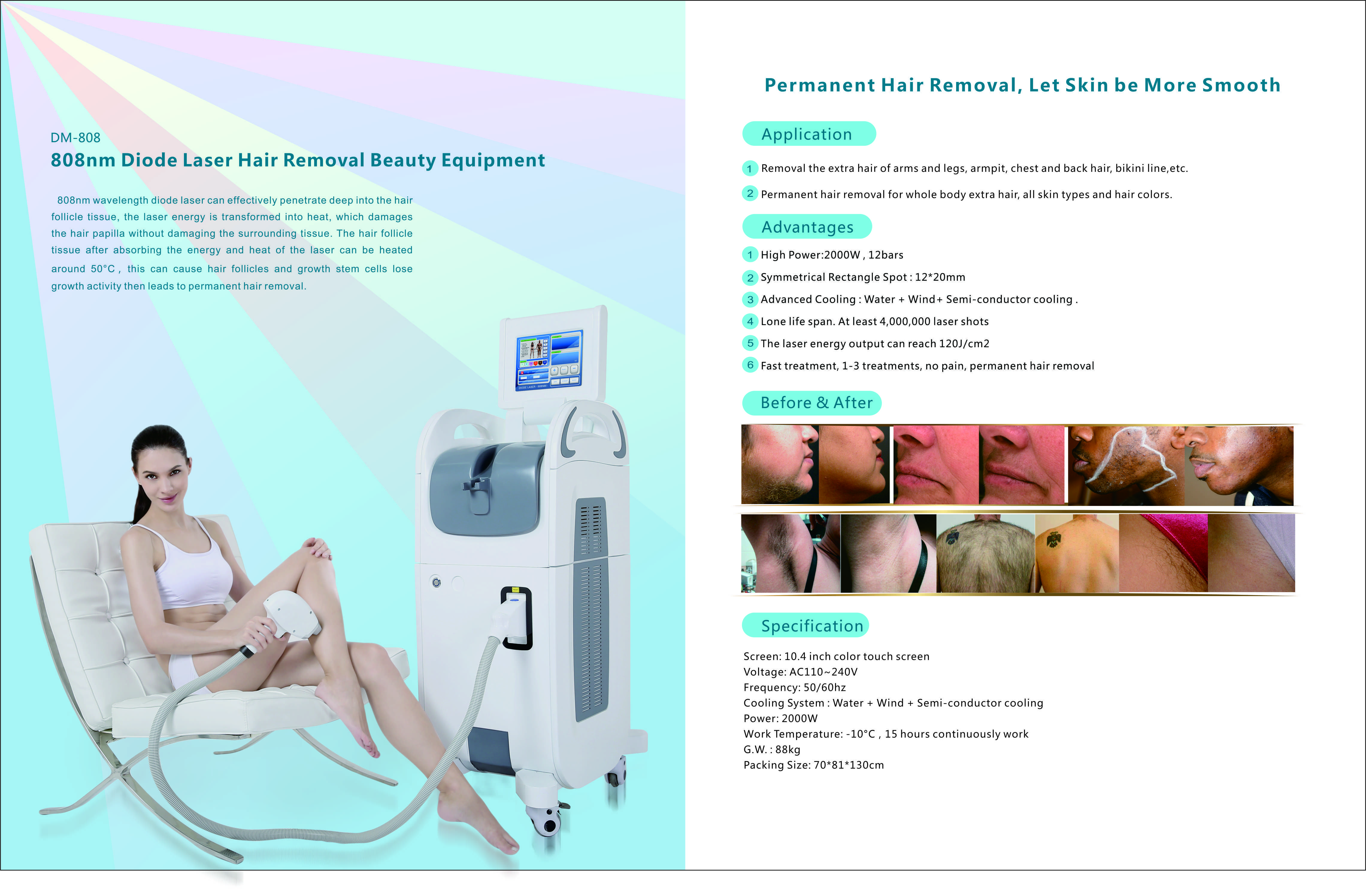 808nm Diode Laser Hair Removal Machine Diode Laser Hair Removal