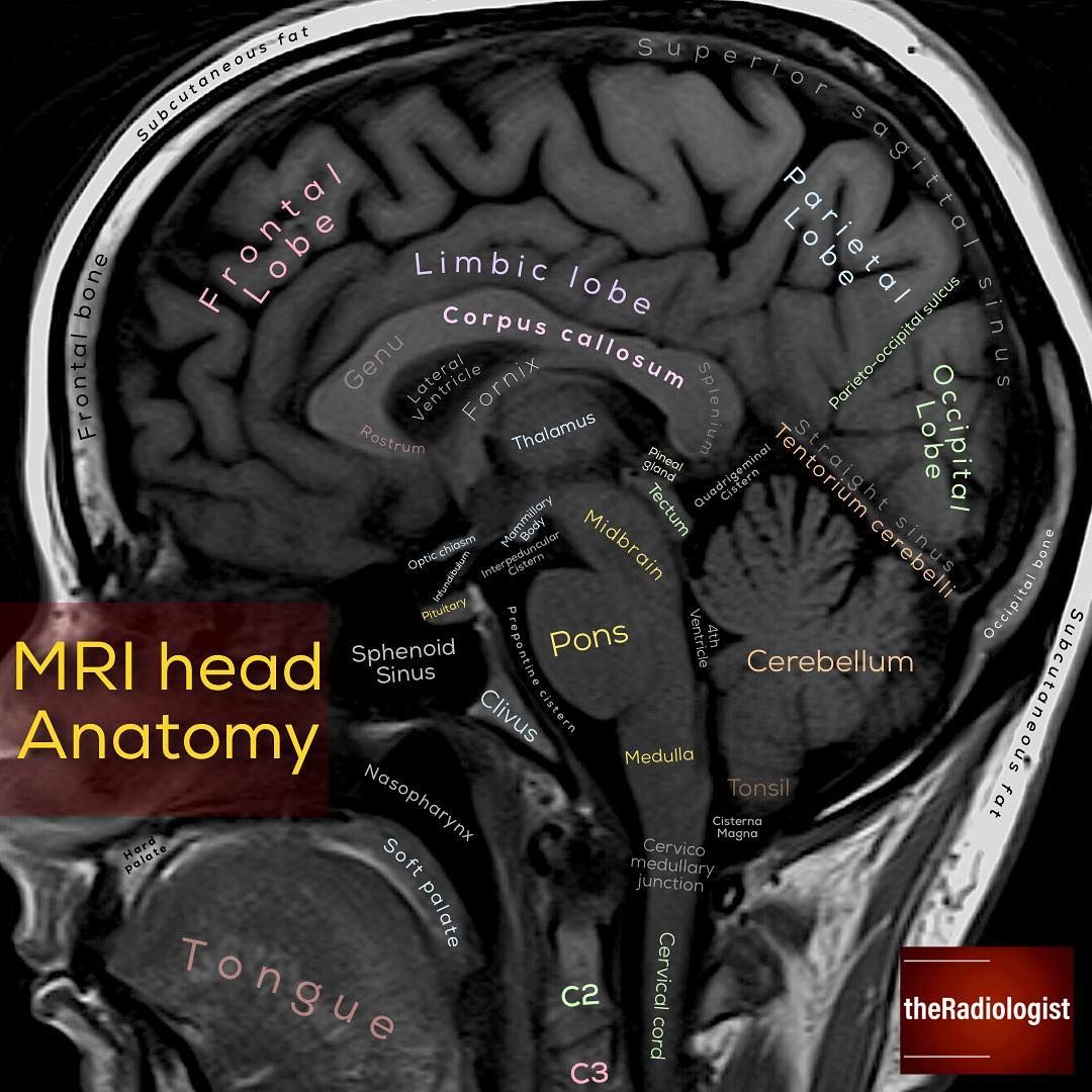 read on for my tips at looking at a sagittal view mri of the how to read mri brain
