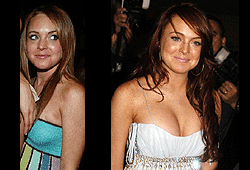 Surgery lindsay lohan boob commit error This idea Surgery lindsay lohan boob