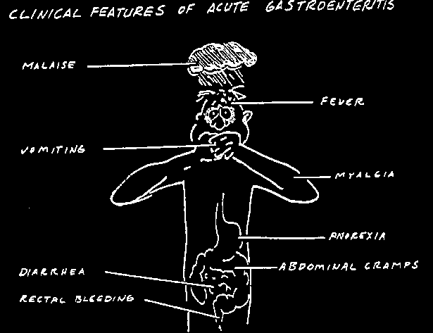what bacteria causes stomach flu what bacteria causes stomach flu