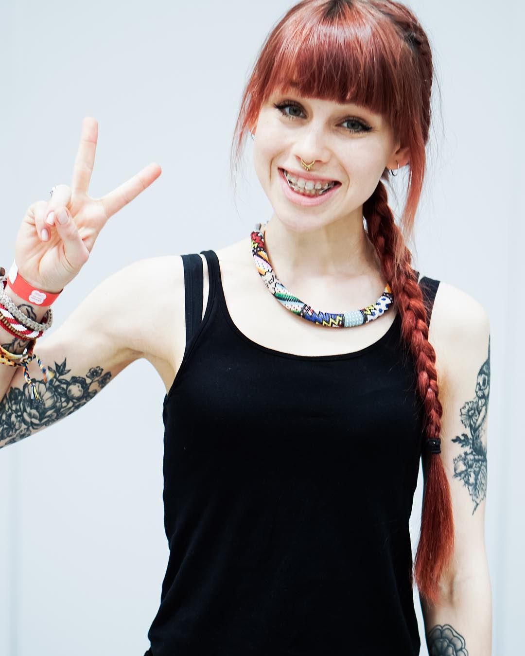 Photos and other amusements - Redhead with braces with braces Redhead