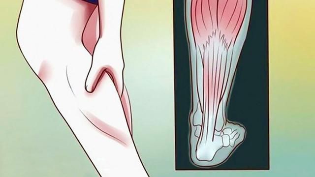 Why Your Legs Cramp At Night And How To Treat And Handle