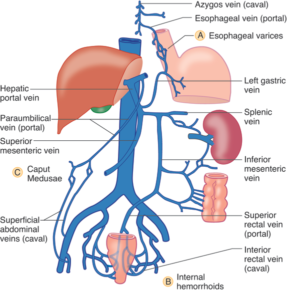 Caput medusae anatomía clínica