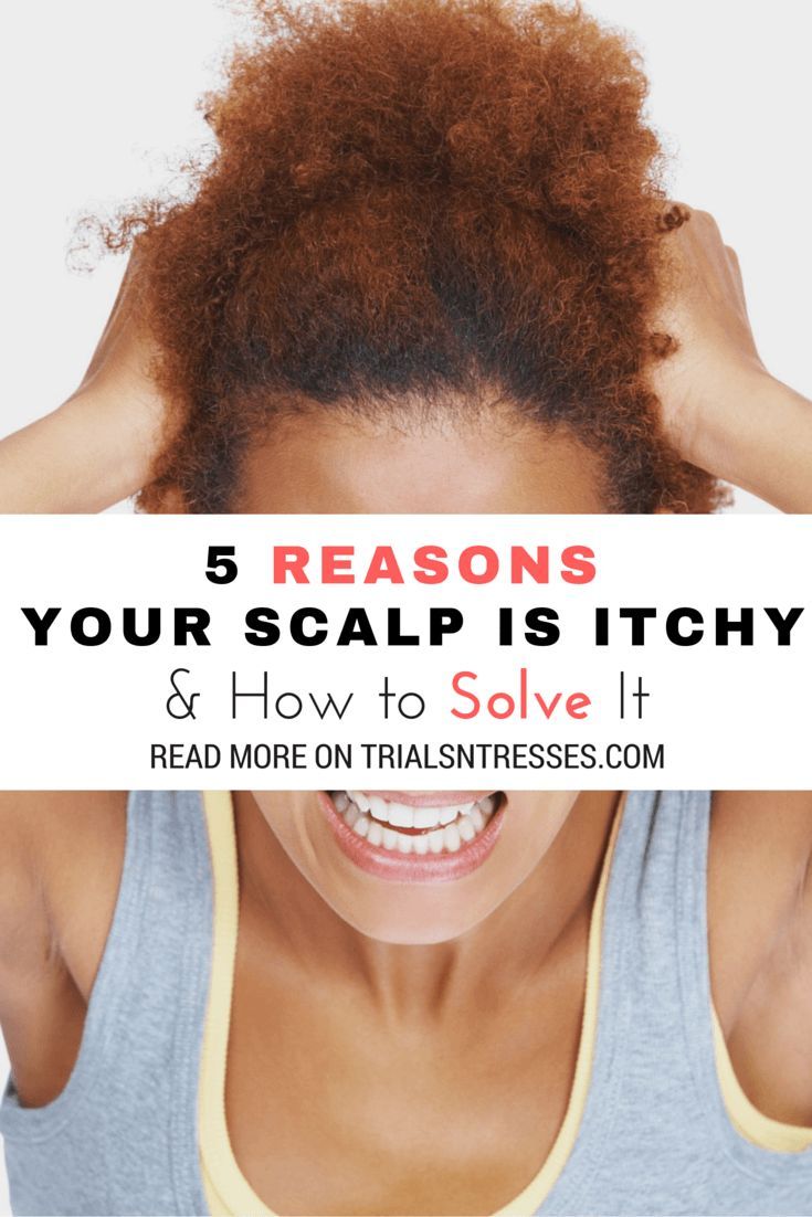 5 Reasons Your Scalp Is Itchy & How To Solve It Millennial in Debt
