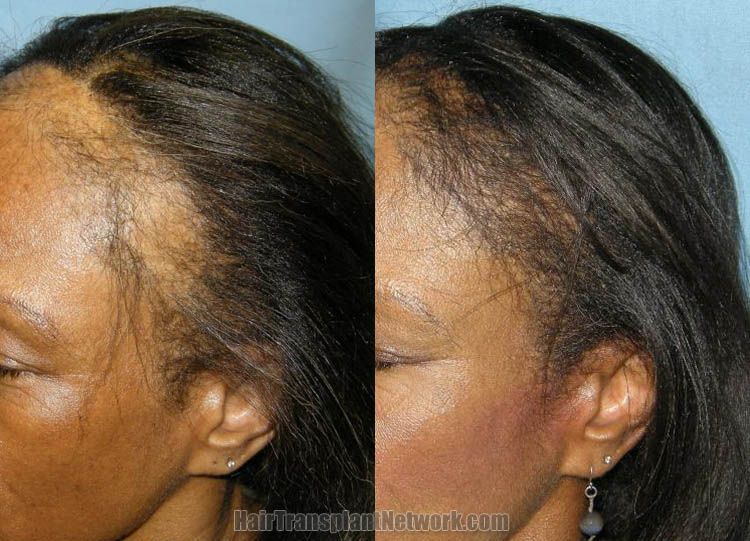 Drink water weight loss study photo 7
