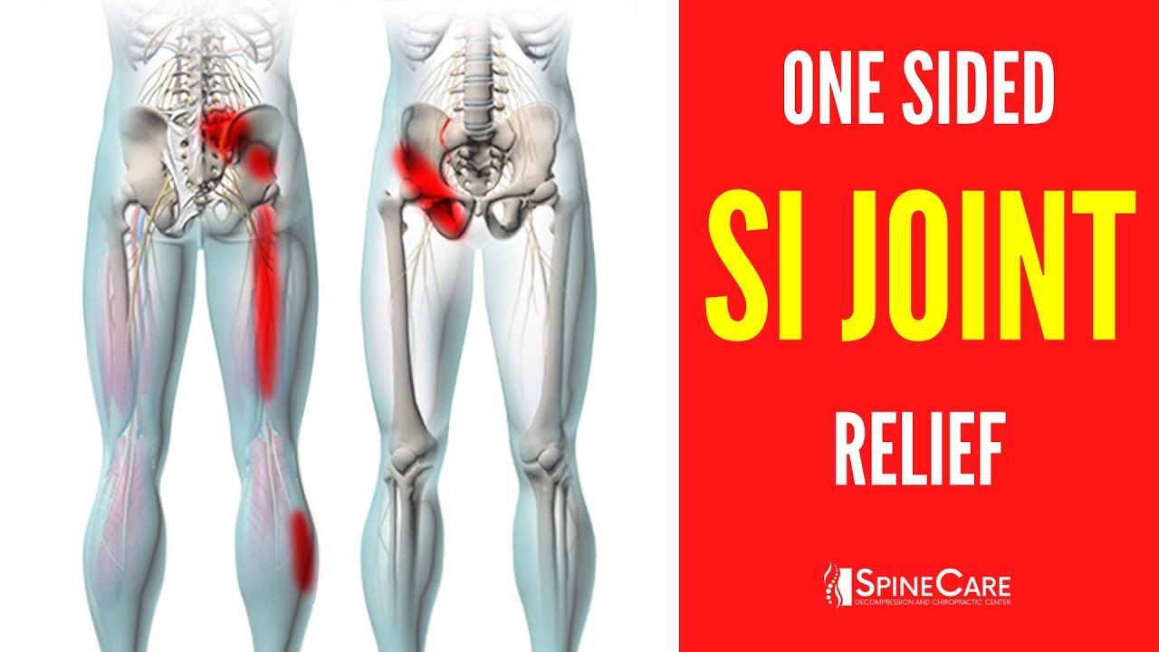Dr. Rowe shows how to instantly fix one sided sacroiliac joint pain.Sacroiliac joint (aka SI joint) dysfunction tends to cause pain around the lower back (ar... Si Joint Pain, Sciatica Relief, Sacroiliac, Leg Pain, Back Pain Relief, Nerve Pain, Rowe, Aka