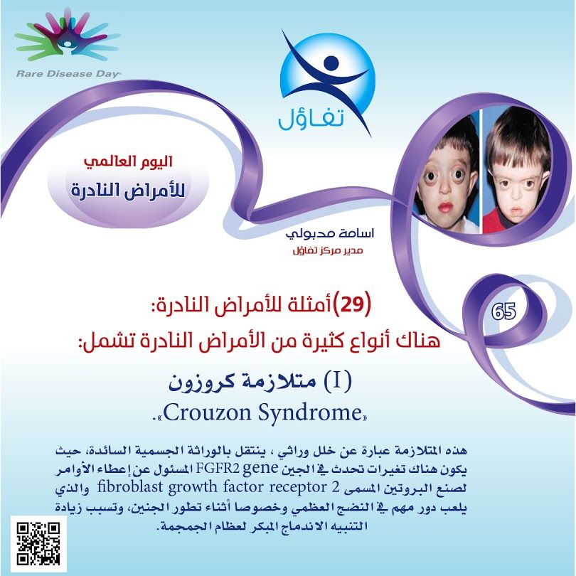Sign In Rare Disease Syndrome Disease