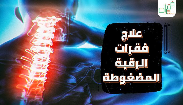 علاج فقرات الرقبة المضغوطة Neon Signs Poster Movie Posters