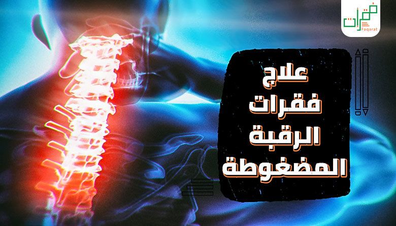 علاج فقرات عنق الرحم المضغوطة.  نيون لافتات ملصق الفيلم