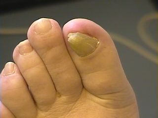 Yellow Toe Nails Pinterest Yellow Toe Nails