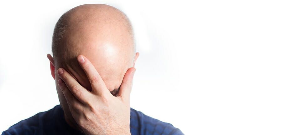 Haarwachstum Nach Haartransplantation Haarwachstum Nach Haartransplantation