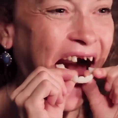 Snap-On Smile That You Can Eat With|Best Teeth Veneers For a Perfect Smile|Covers Chipped teeth in 2020 | Snap on smile, Teeth covers, Veneers teeth