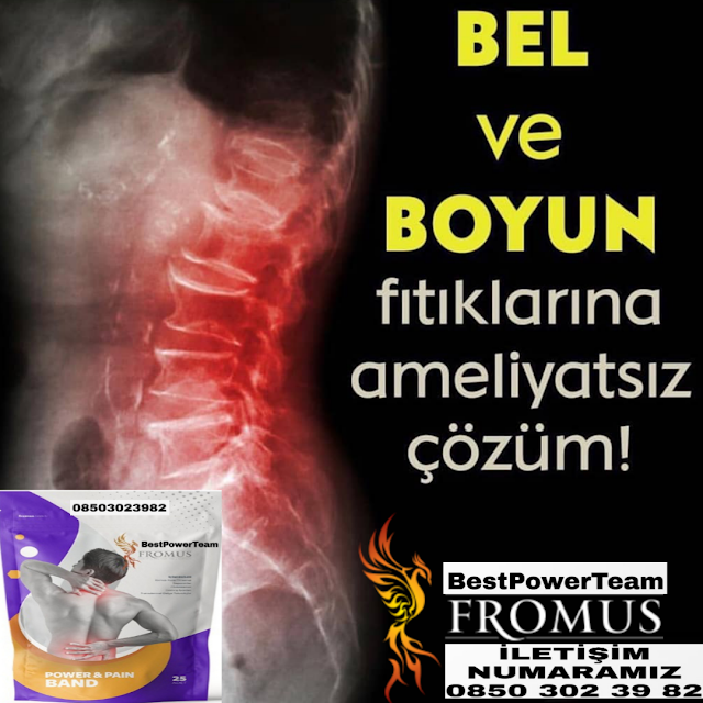 Pin On Fromus Power Pain Band Saglik