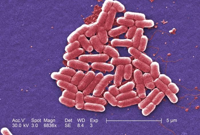 E Coli Mind Map Mind Map Mindfulness Medical Students
