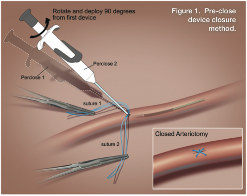 Pin On Cath Lab Images pin-on-cath-lab-images